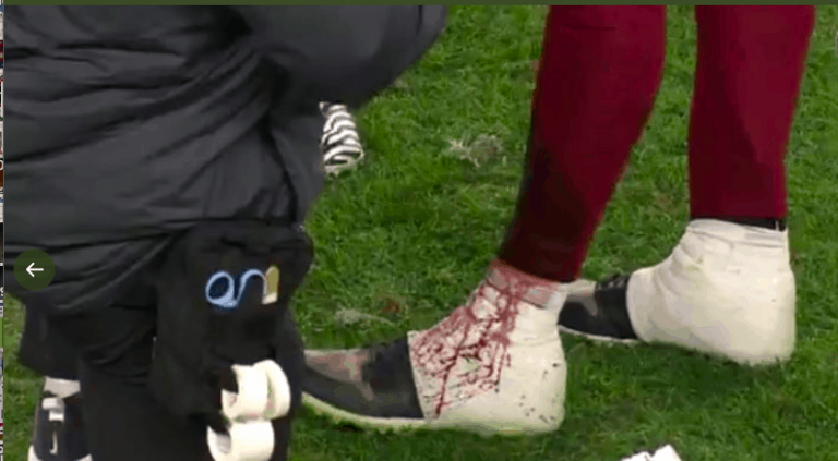 NFL's washington football team quarterback alex smith bloody ankle curt schilling