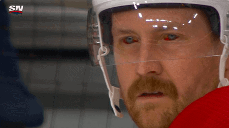 Montreal Canadiens defenseman Jeff Petry explained how his infamous bloodshot eyes pic was a product of an incredibly painful pinky injury